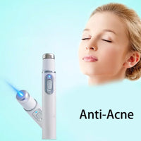 Blue Light Therapy Acne Pen – Effective against impure skin