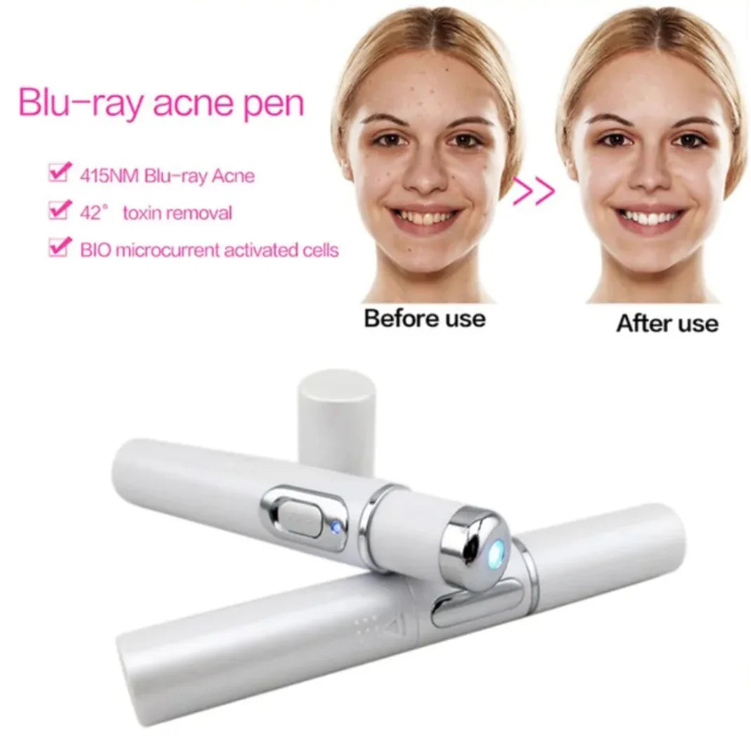 Blue Light Therapy Acne Pen – Effective against impure skin