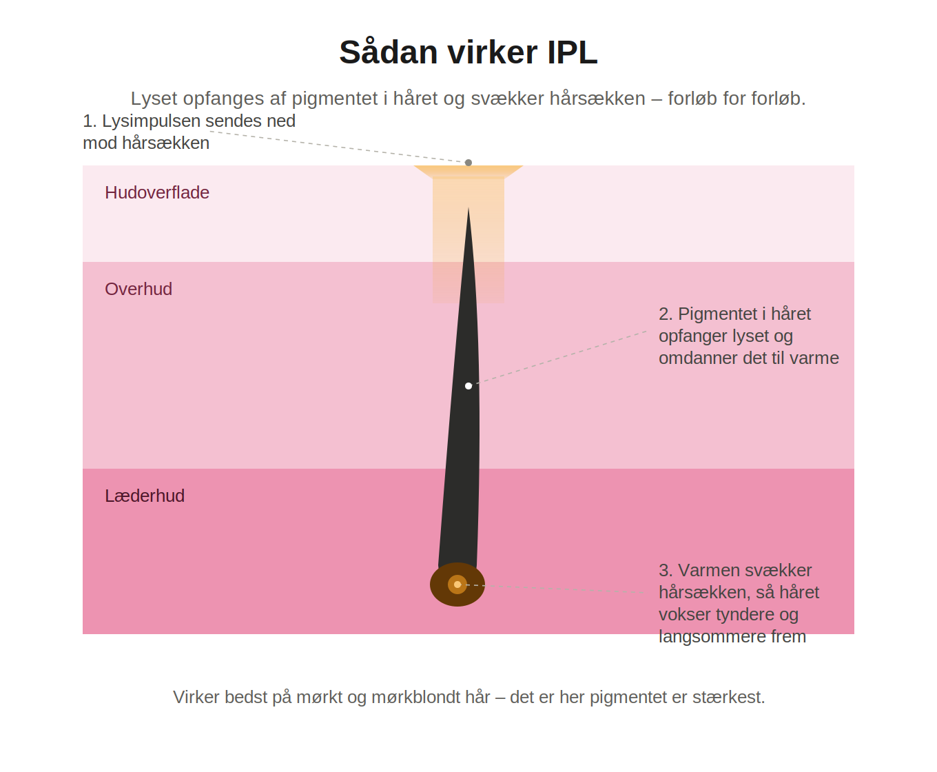 Aveline Lumi – IPL Hårfjerner til Krop og Ansigt